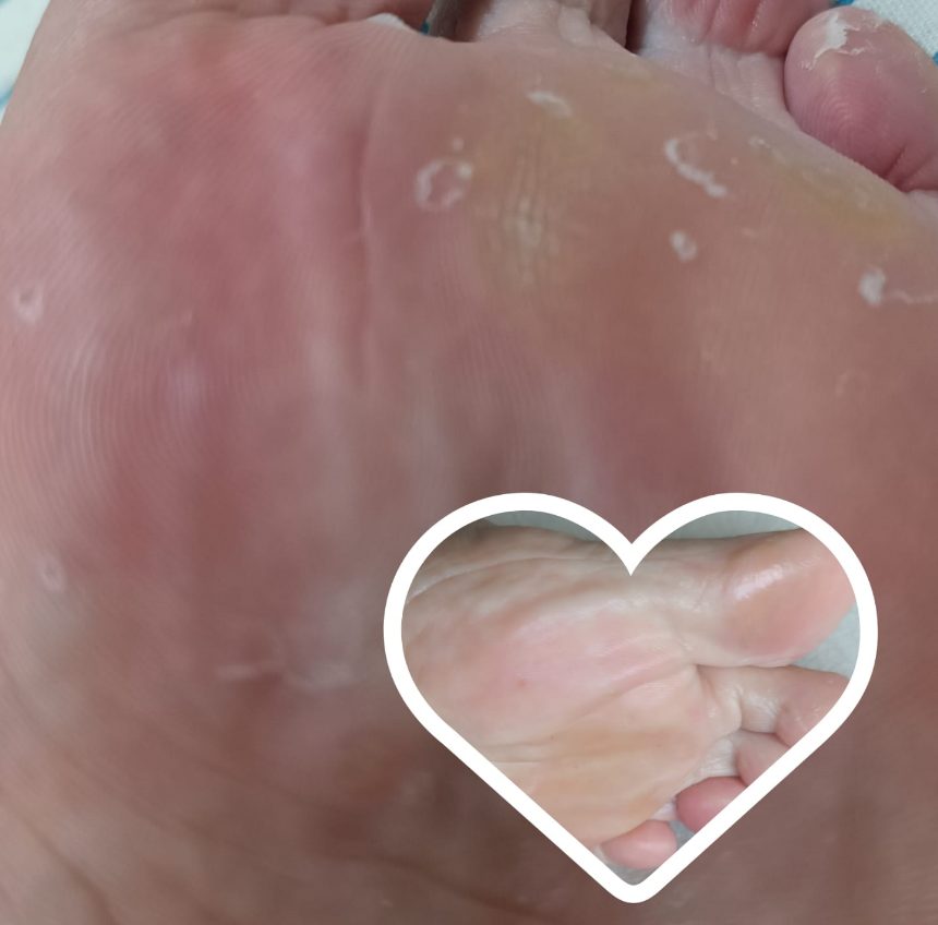 Alethe’s foot supporting image